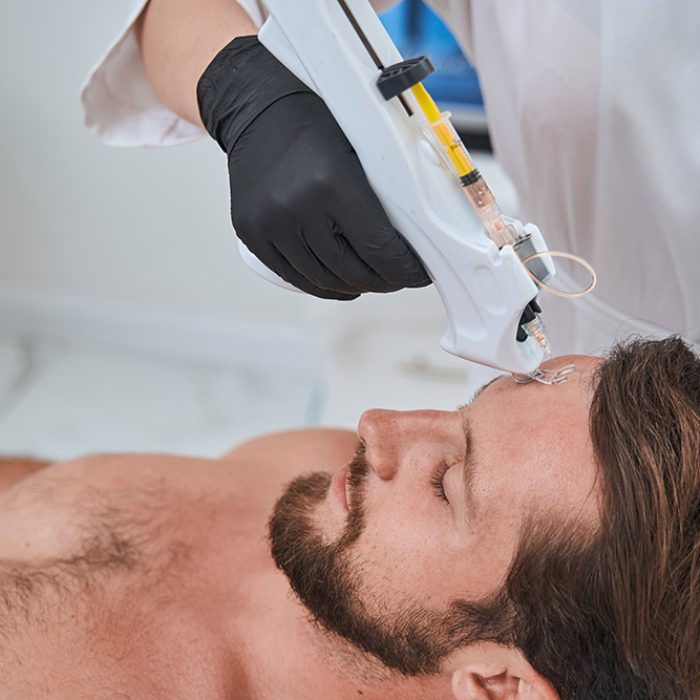mesoterapia antiedad lleida